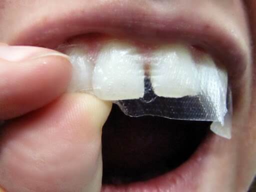 Bước 2 Cách sử dụng Miếng dán trắng răng
