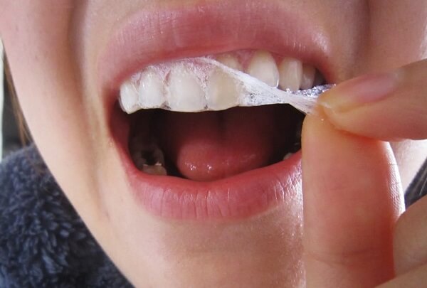 Bước 4 Cách sử dụng Miếng dán trắng răng