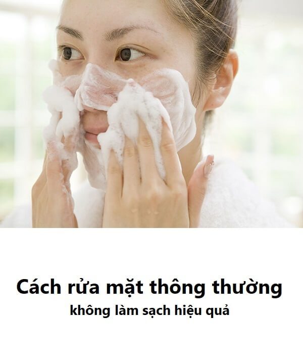 Máy rửa mặt Laco Luxury có nên mua không