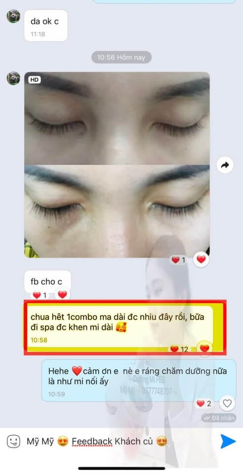 Review Dưỡng mi FEG đánh giá từ phía người dùng 5