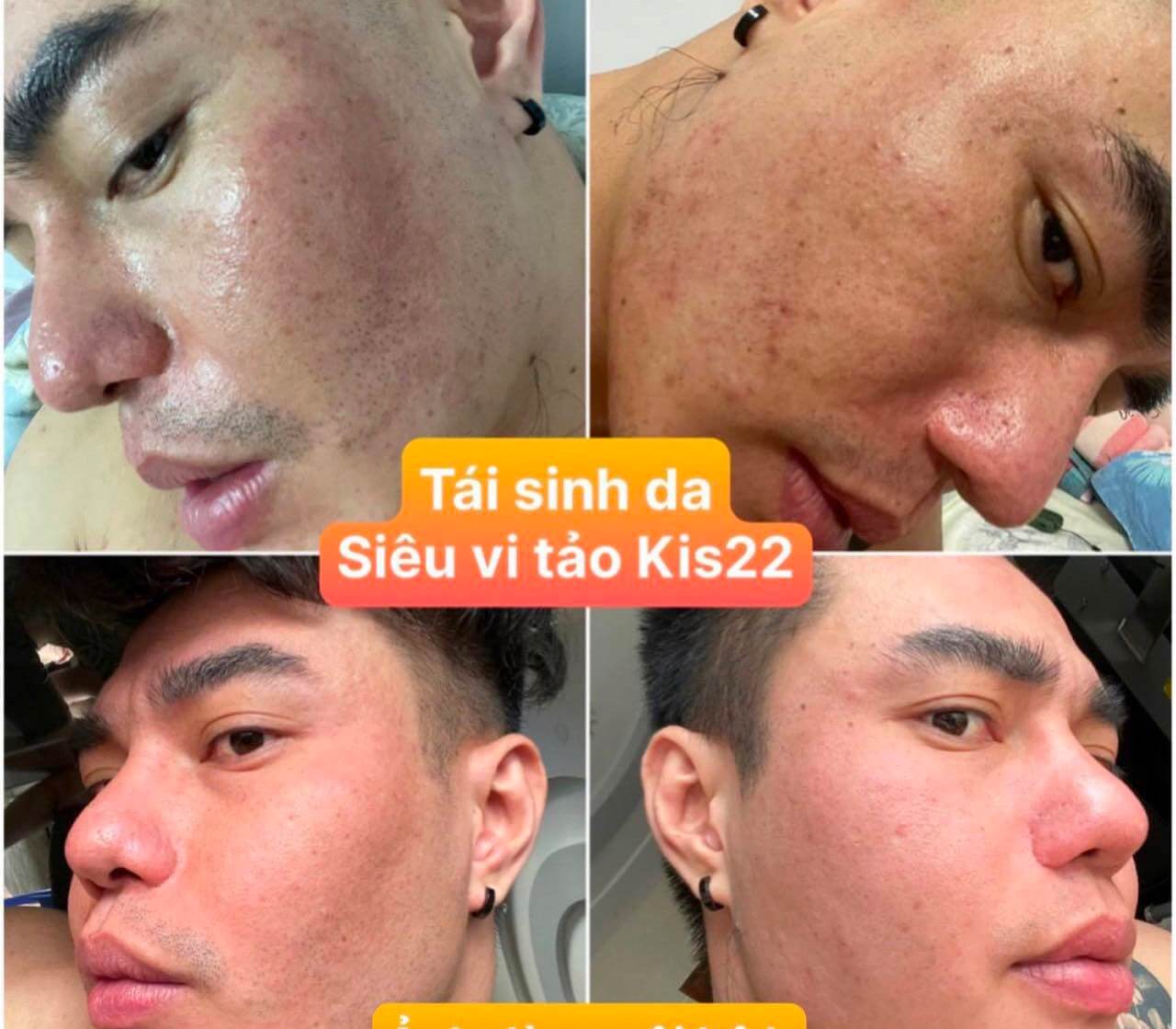 Serum Green Vita siêu vi tảo hình 18