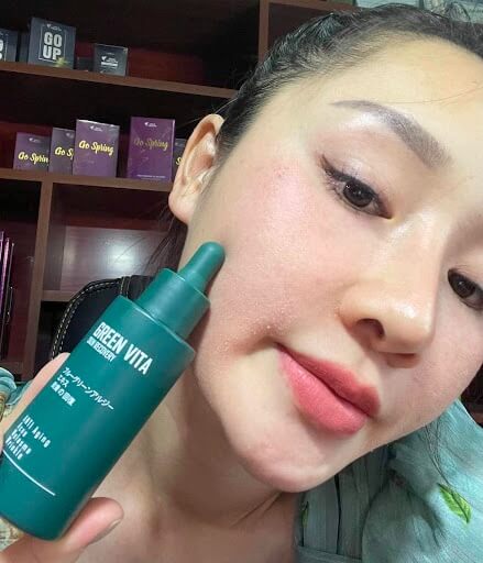 Serum Green Vita siêu vi tảo hình 29