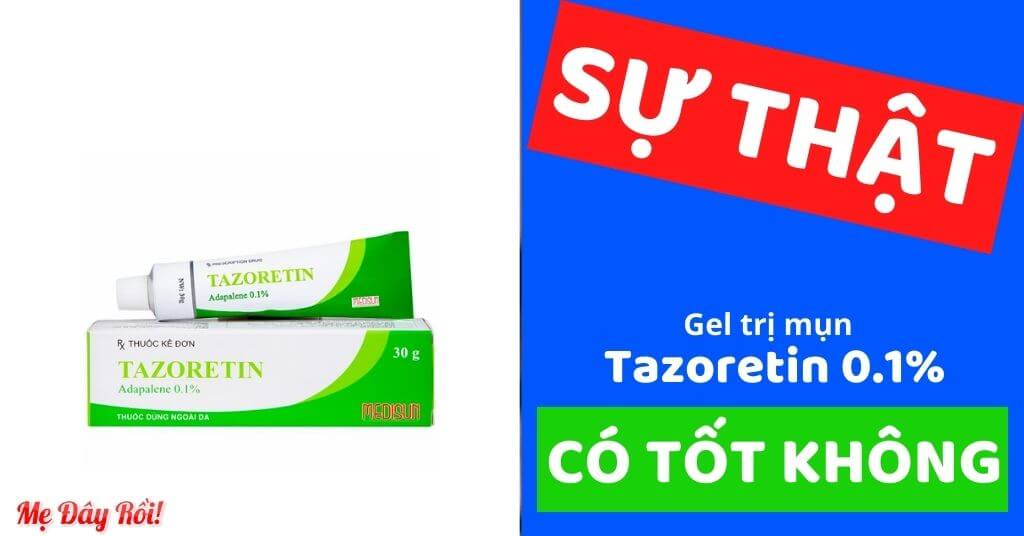 Review tazoretin 0.1 gel có tác dụng gì, có trị mụn ẩn không, có đẩy nhân mụn không