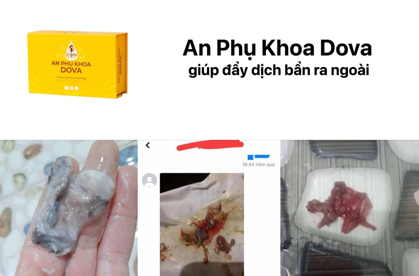 Review viên đặt An Phụ Khoa Dova có tốt không giá bao nhiêu có lừa đảo hình 27