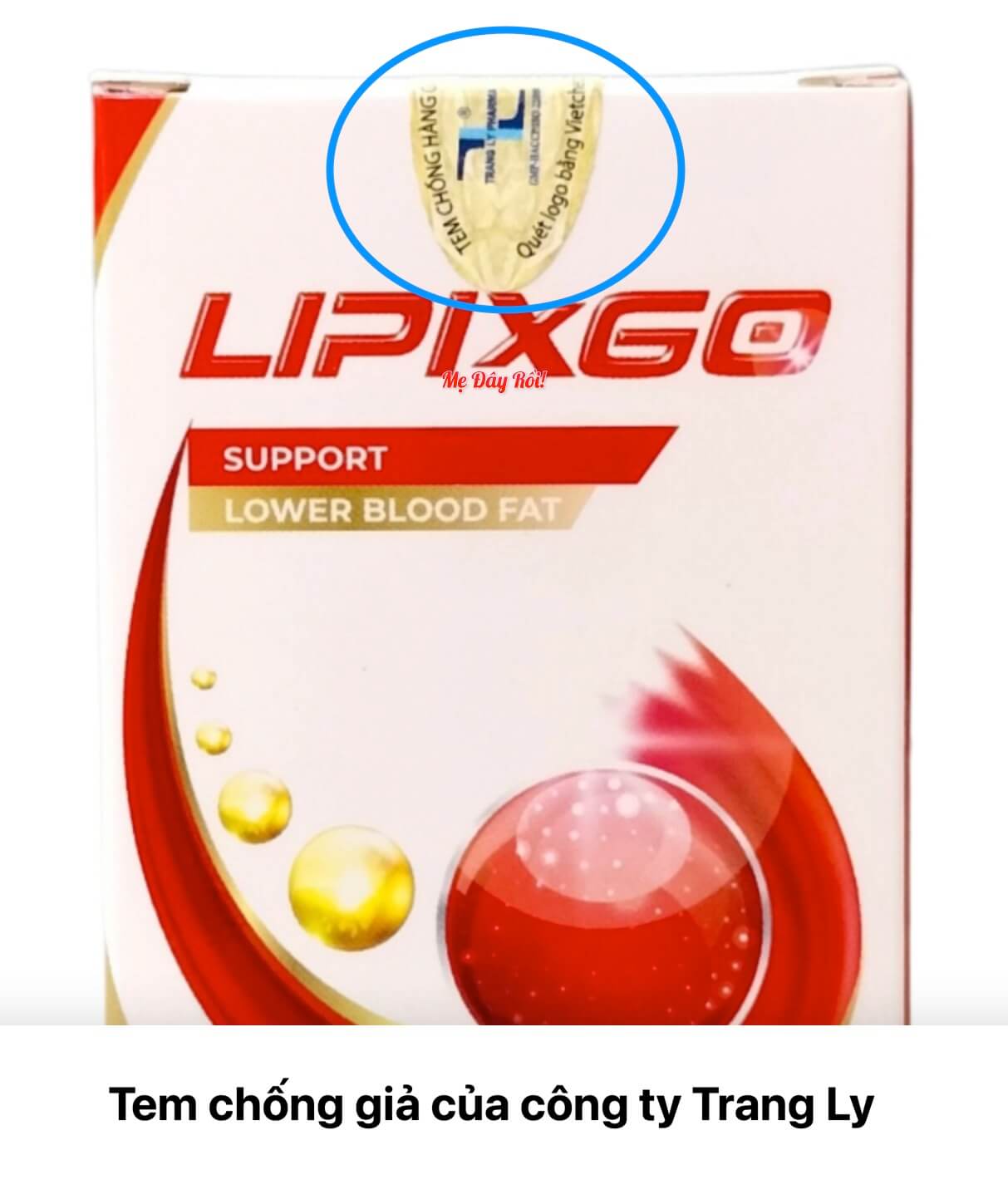 Lipixgo hỗ trợ giảm mỡ máu có tốt không? Giá bao nhiêu? Mua ở đâu chính hãng? hình 28
