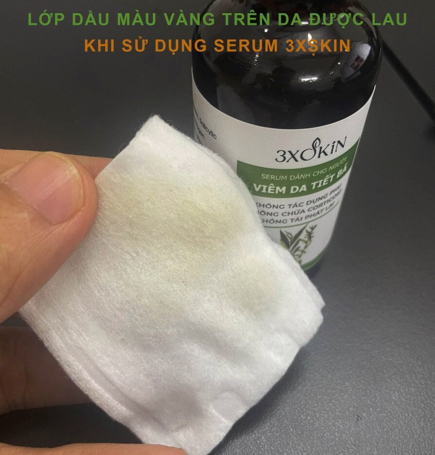 Serum 3XSKIN có tốt không trị viêm tiết bã giá bao nhiêu lừa đảo hình 9