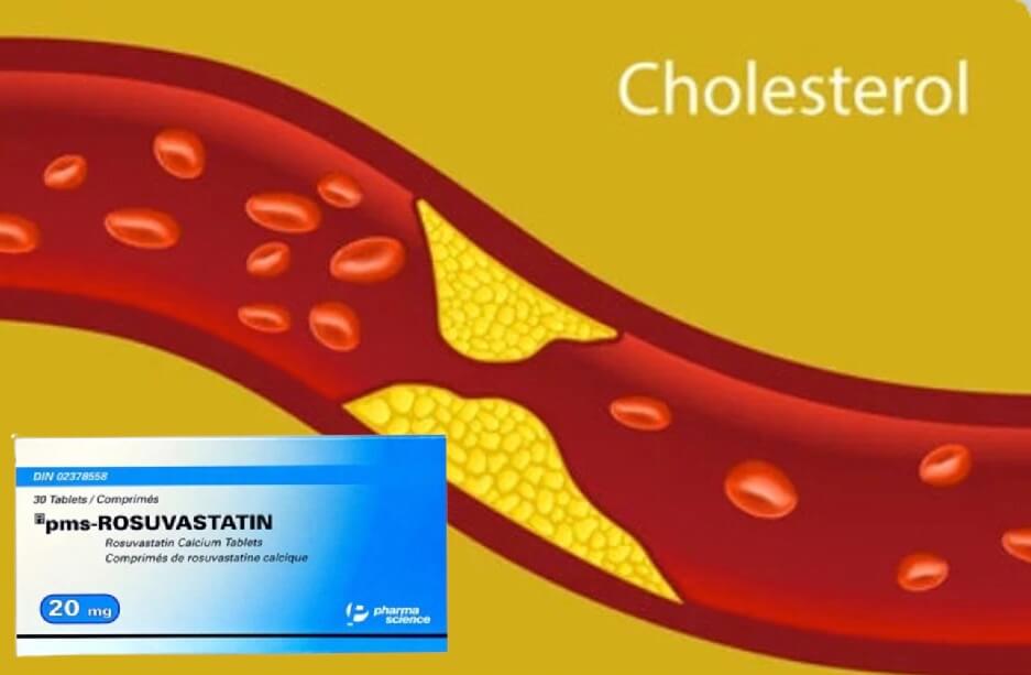 Thuốc pms-Rosuvastatin 20mg điều trị tăng cholesterol nguyên phát (loại IIa), rối loạn lipid hỗn hợp (loại IIb), tăng cholesterol gia đình kiểu đồng hợp tử, phòng ngừa các biến cố tim mạch hình 5