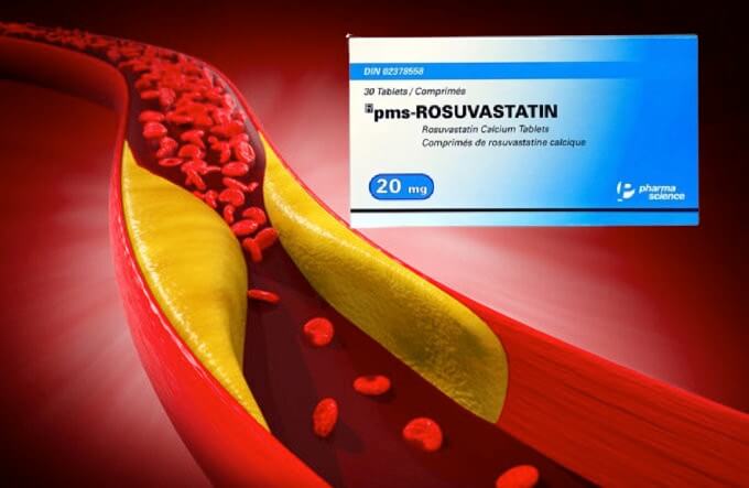 Thuốc pms-Rosuvastatin 20mg điều trị tăng cholesterol nguyên phát (loại IIa), rối loạn lipid hỗn hợp (loại IIb), tăng cholesterol gia đình kiểu đồng hợp tử, phòng ngừa các biến cố tim mạch của công ty Pharmascience Inc., số đăng ký VN-18412-14 hình 6