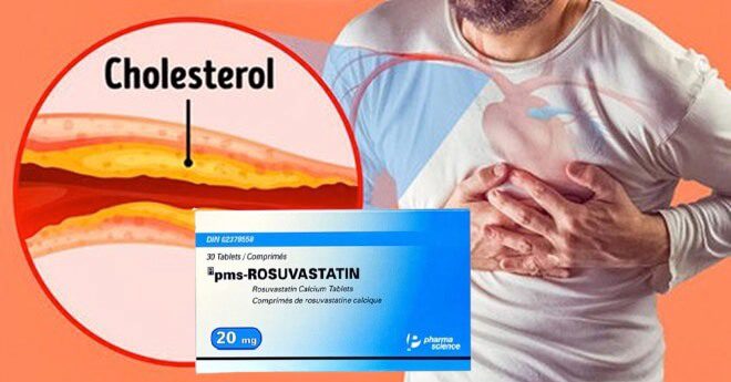 Thuốc pms-Rosuvastatin 20mg điều trị tăng cholesterol nguyên phát (loại IIa), rối loạn lipid hỗn hợp (loại IIb), tăng cholesterol gia đình kiểu đồng hợp tử, phòng ngừa các biến cố tim mạch của công ty Pharmascience Inc., số đăng ký VN-18412-14 hình 7