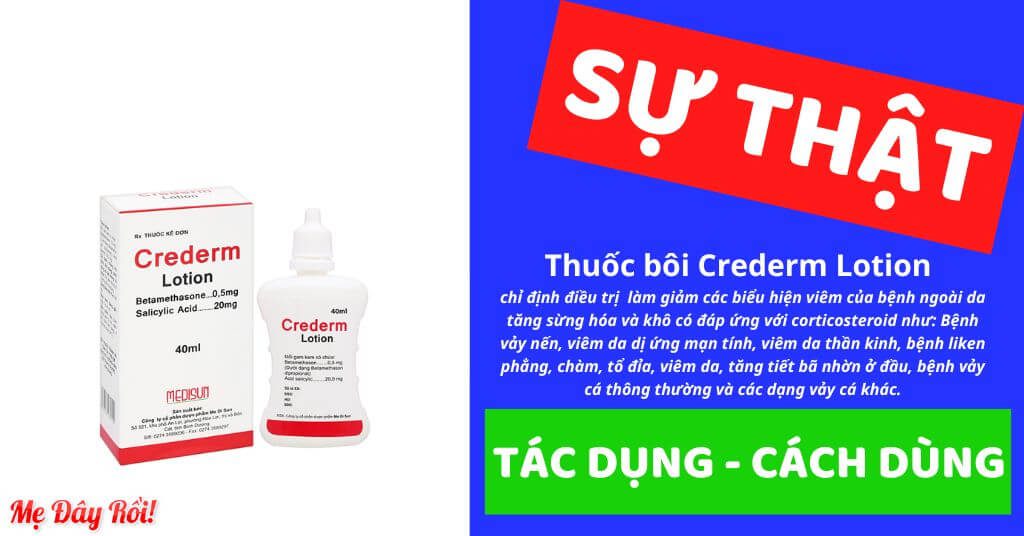 Crederm Lotion là thuốc gì, công dụng, giá bao nhiêu, cách sử dụng