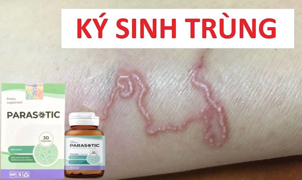 Thuốc Parasitic diệt ký sinh trùng, giun sán