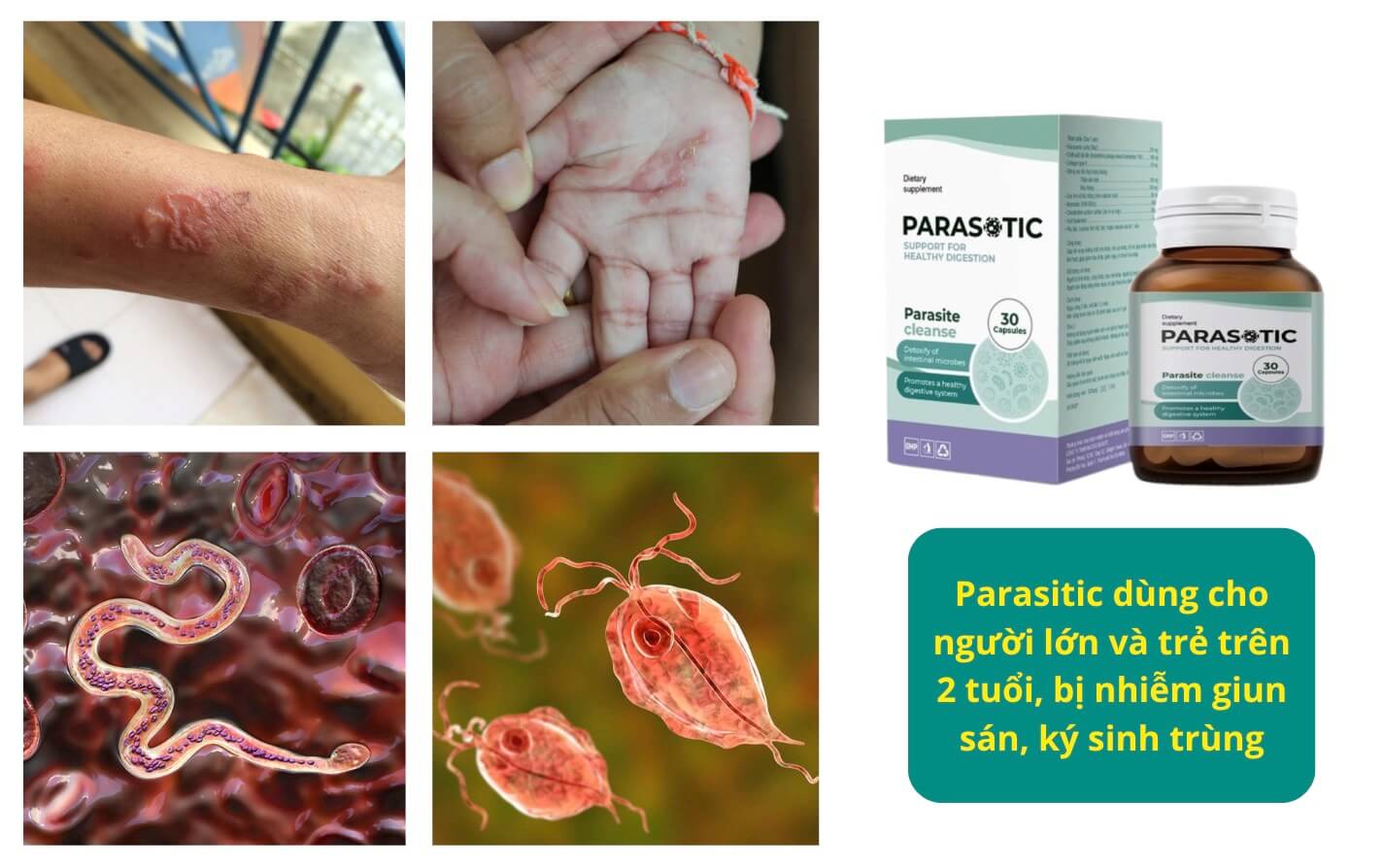 Parasitic lừa đảo là không chính xác