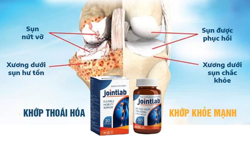 Thuốc jointlab là thuốc gì